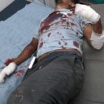 भारतमा गाडीले ठक्कर दिएर प्युठान ऐरावतीका खुमबहादुर राउत घाइते परिवारद्वारा सहयोगको अपिल